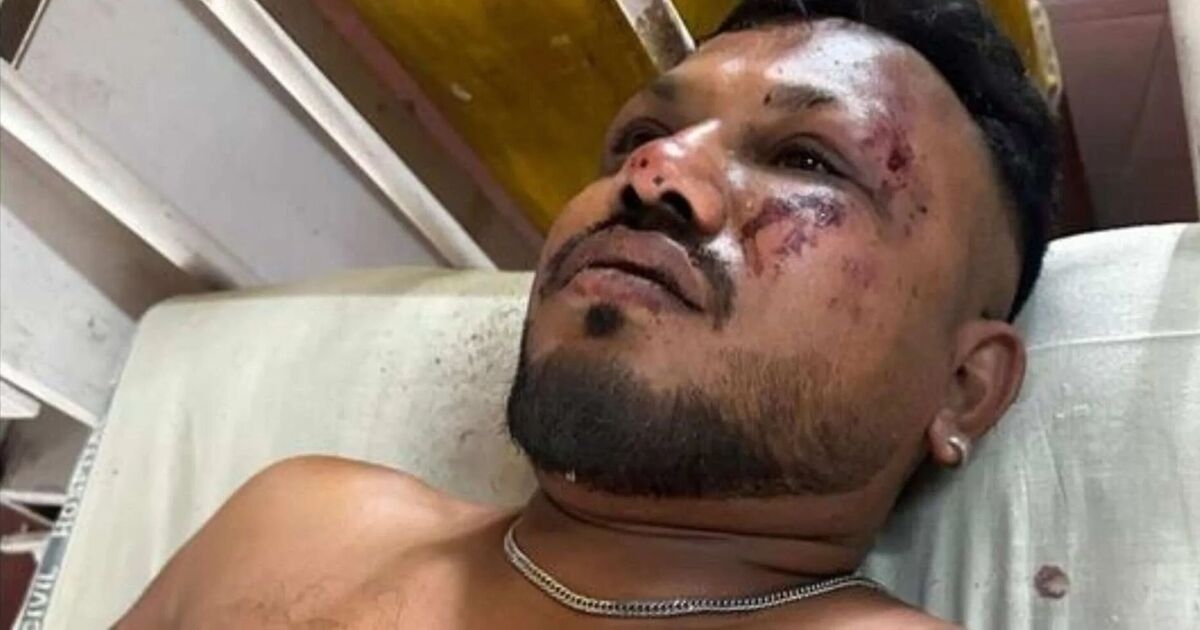 Fúria enquanto ator famoso acusa sobrevivente do acidente da Air India de mentir