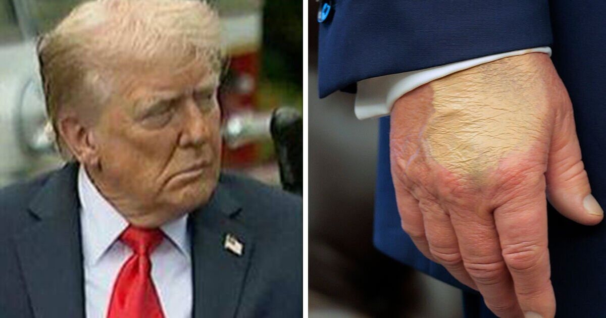 Опасения Трампа по поводу здоровья доказывают, что каждый стареющий мировой лидер должен пройти этот тест, считает эксперт