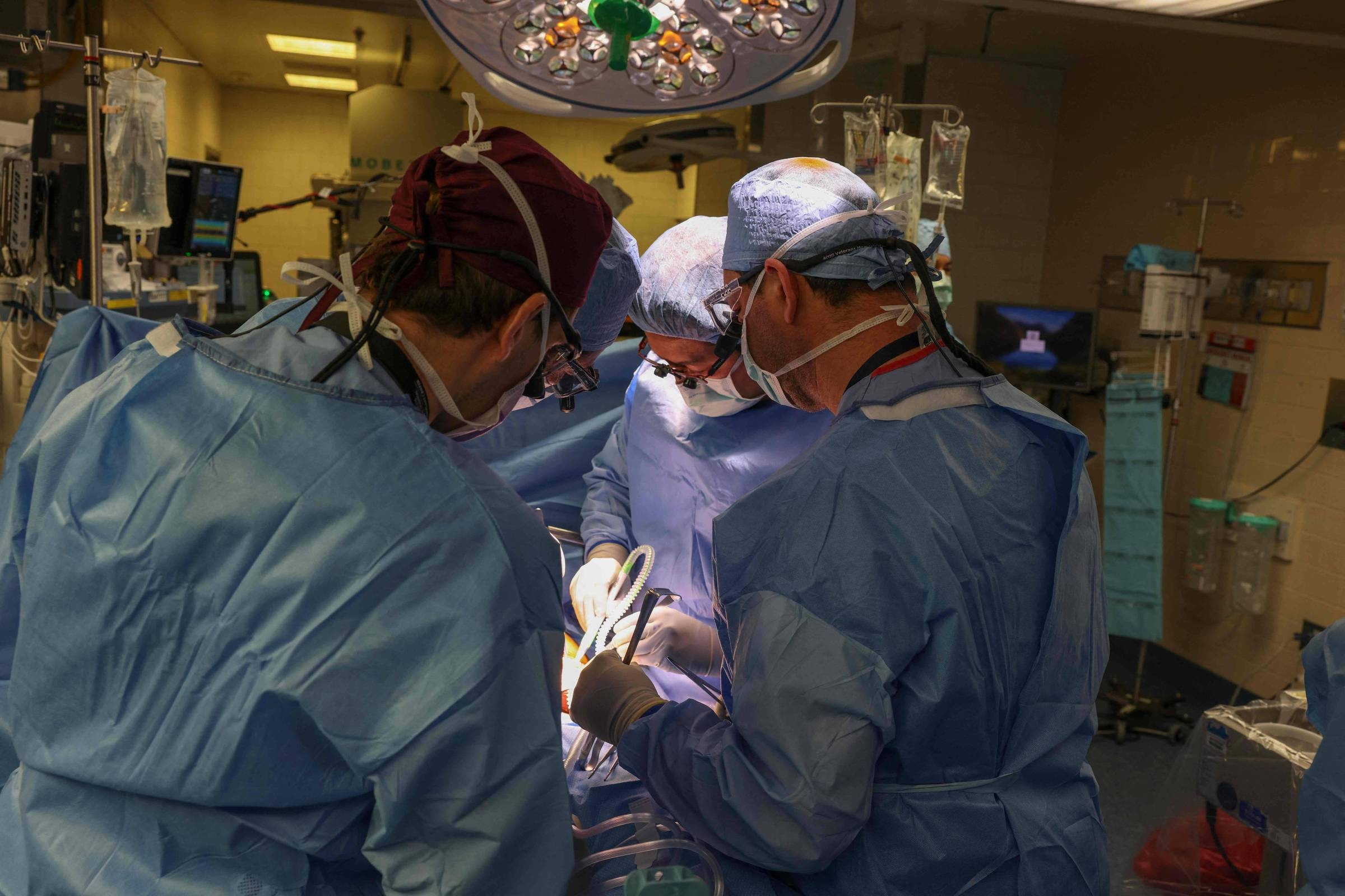 Study identifies why the human body rejects a pig kidney transplant