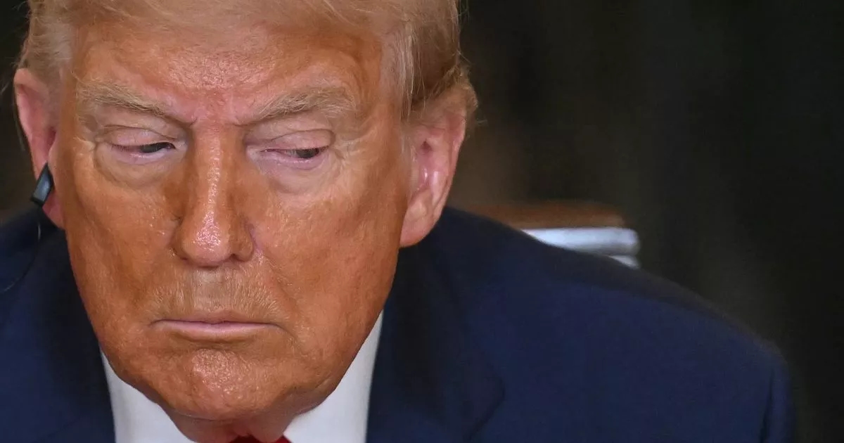 Kronik venöz yetmezlik: Donald Trump'ı etkileyen rahatsızlığın belirtileri ve tedavisi