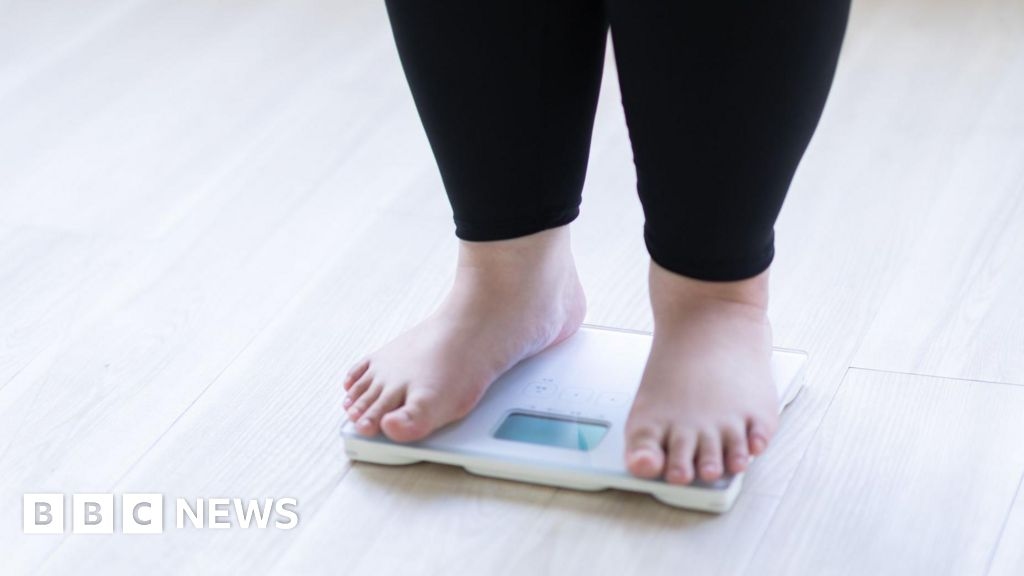 Child obesity clinics seeing BMIs over 50