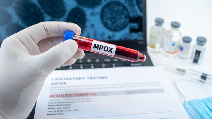 WHO says M pox remains a public health emergency