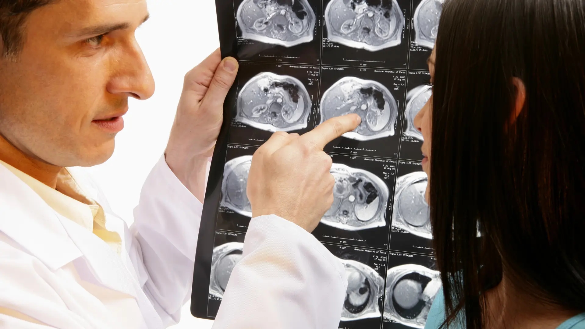 El cáncer olvidado que aumenta entre los jóvenes y desconcierta a los expertos