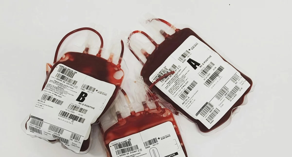Anemia: síntomas y tratamiento de la anemia