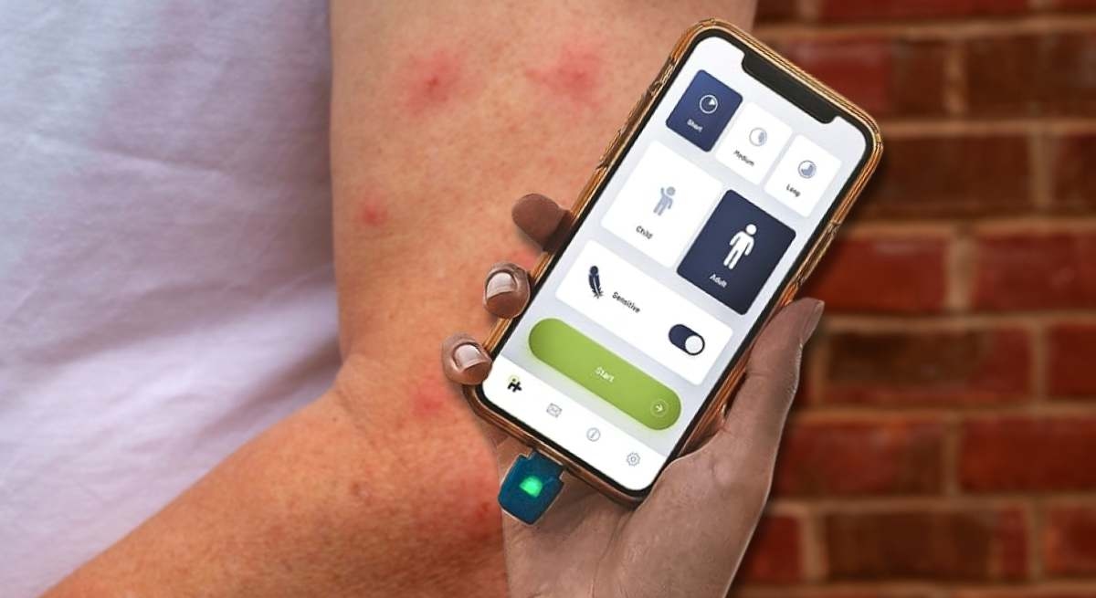 Dite addio ai danni provocati dalle punture di zanzara: l'invenzione che elimina il prurito del cellulare