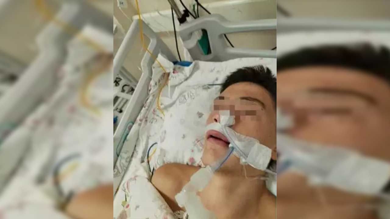 Снова издевательства со стороны сверстников! Его избили за то, что он наступил ему на ногу, и он получил кровоизлияние в мозг.