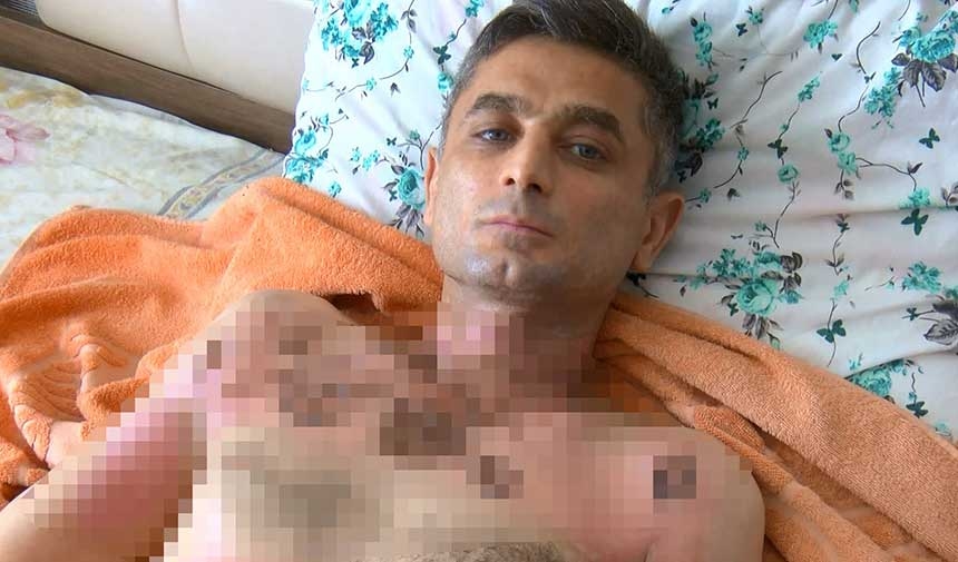 After stealing his phone, he poured gasoline on it and set it on fire because he complained about it