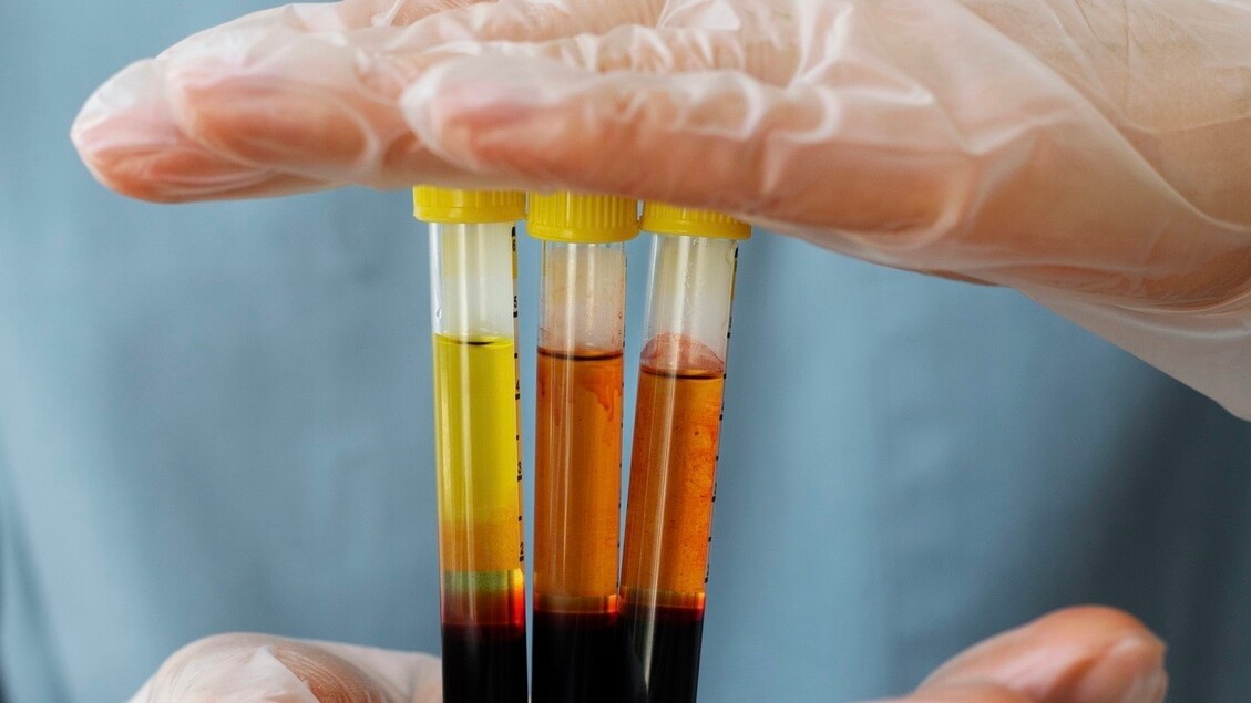 Rumo a testes portáteis, rápidos e precisos para futuras pandemias