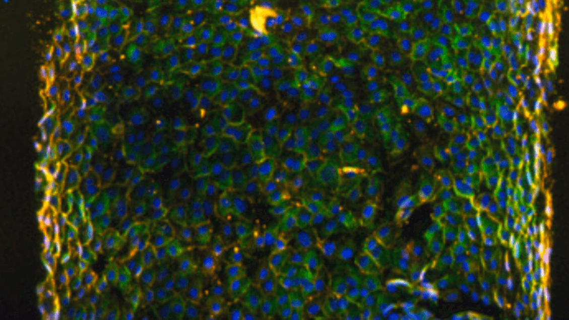 Biorreator que reproduz tumores em laboratório está pronto