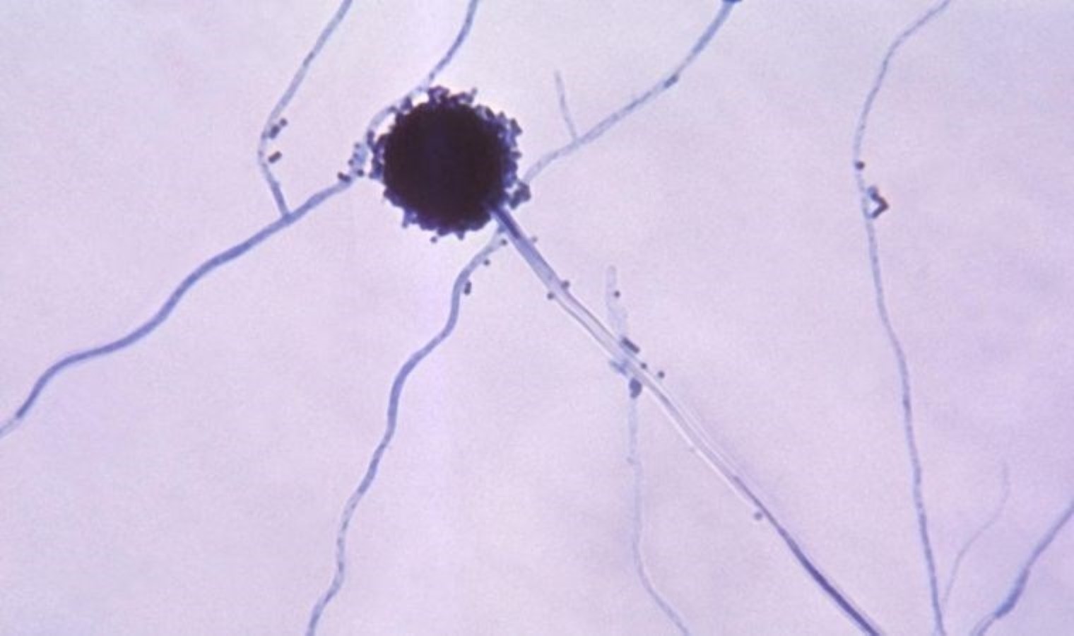 Un champignon mortel qui cause des problèmes pulmonaires pourrait se propager dans toute l'Europe