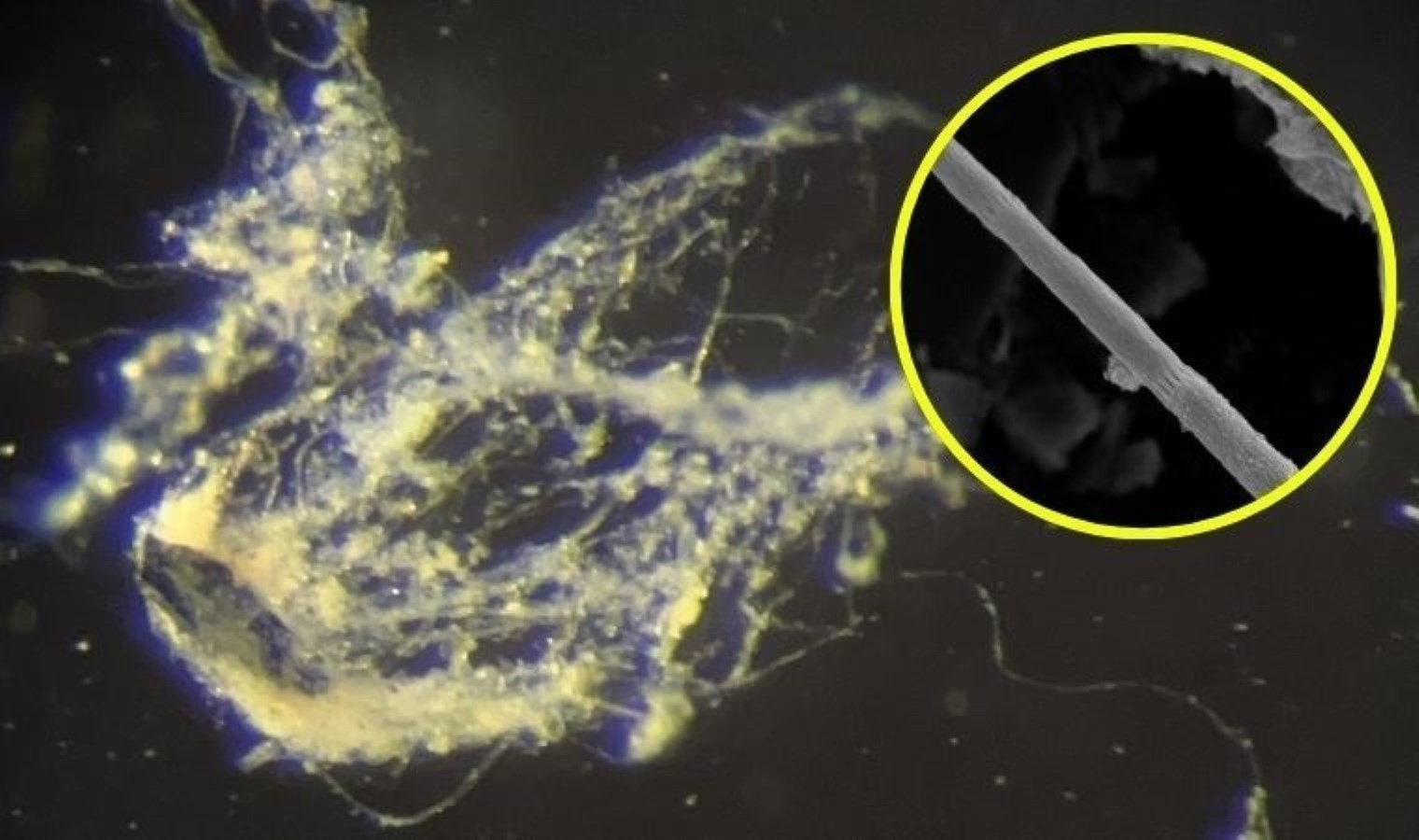 Découverte de bactéries capables de transporter l'électricité
