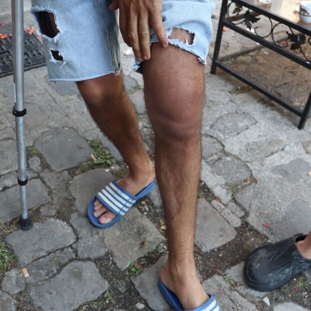 Montreuil (93): na tle „spóru o wynajem” dwóch mężczyzn brutalnie zaatakowanych przez właściciela domu i około trzydziestu wspólników uzbrojonych w tępe narzędzia