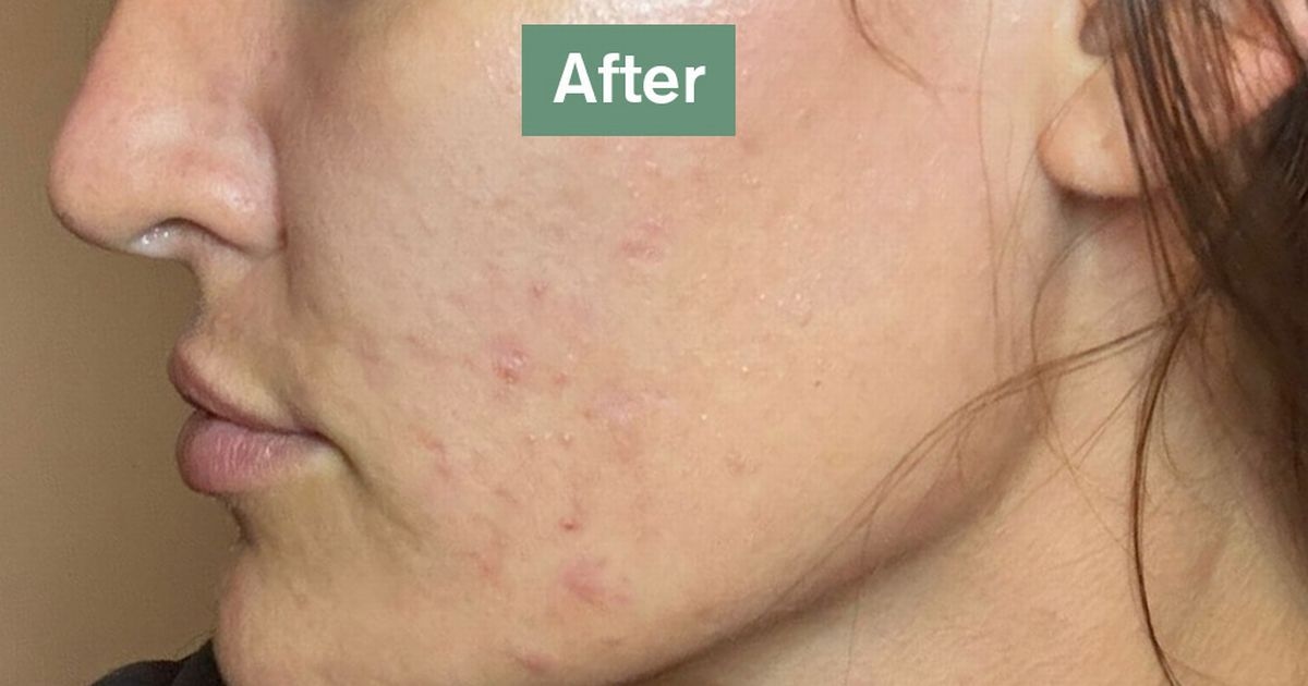 Таблетки по 61 пенсу в день уменьшают «морщины» и «мешки под глазами исчезают» у покупателей